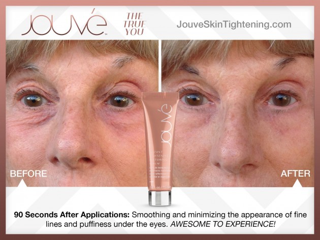 jouve_heshie_before_and_after-1