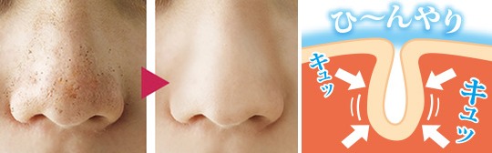 nose-pore-blocker-cap-hanabijin-2